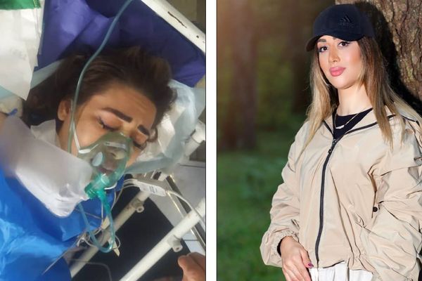 بعد إجراء عملية جراحية لها بالرئة.. سيدة تعرضت لإطلاق نار من الأمن الإيراني في "حالة حرجة"