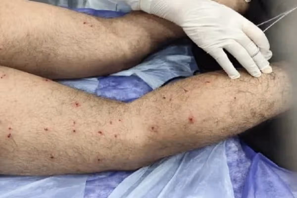 عضو کمیسیون بهداشت مجلس: شورای تامین خواستار تحویل اطلاعات پزشکی مجروحان شده است