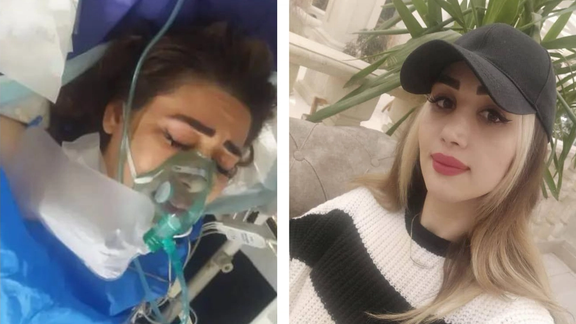 Badri before and after being shot by the police in July