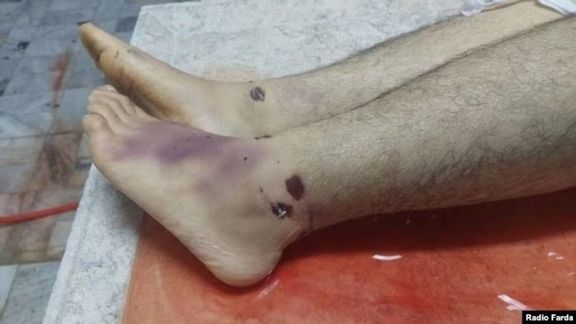 This photo shows the injuries and bruises on Peyman Galvani's legs.