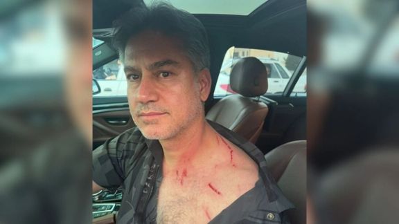 حمله سارقان موتور سوار به مربی تیم ملی فوتبال