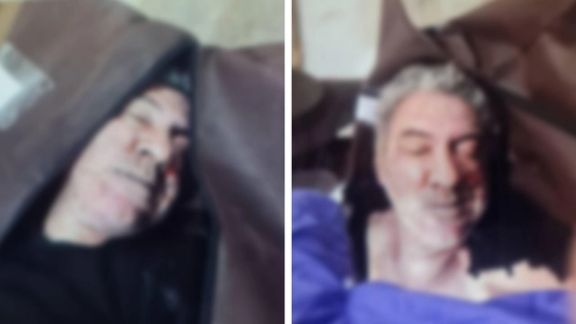 تصاویری اختصاصی حاکی از آثار ضرب و جرح در سر و صورت محمدرضا بالیلاشک، معترض کشتهشده