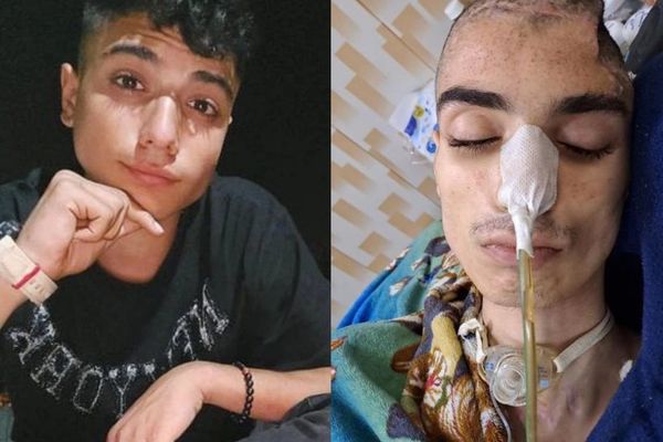 مقتل متظاهر إيراني بعد 8 أشهر من إصابته بعبوة غاز مسيل للدموع في رأسه