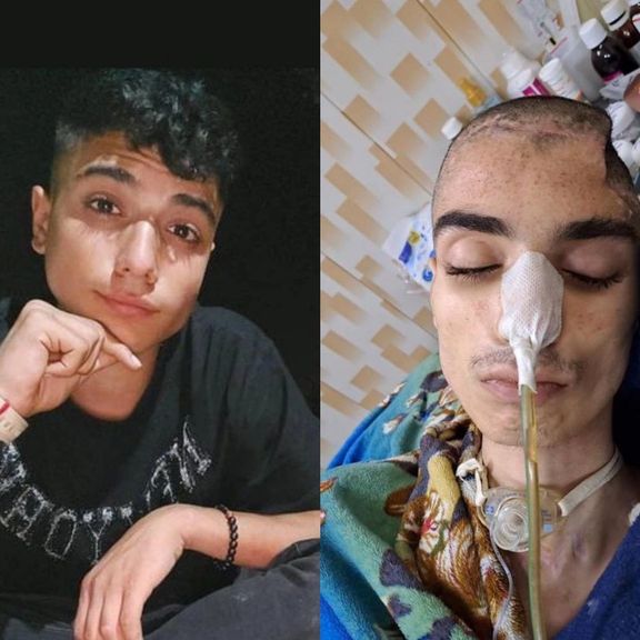 کودک دیگری قربانی شد؛ مرگ ابوالفضل امیرعطایی، هشت ماه پس از اصابت گلوله گاز اشکآور به سرش