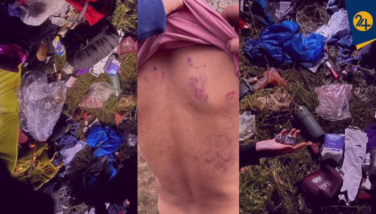 یکی از مضروبان کمپ اوپرت: مهاجمان نظامی بودند، زدند و گفتند حالا فهمیدید عاشورا چه شده