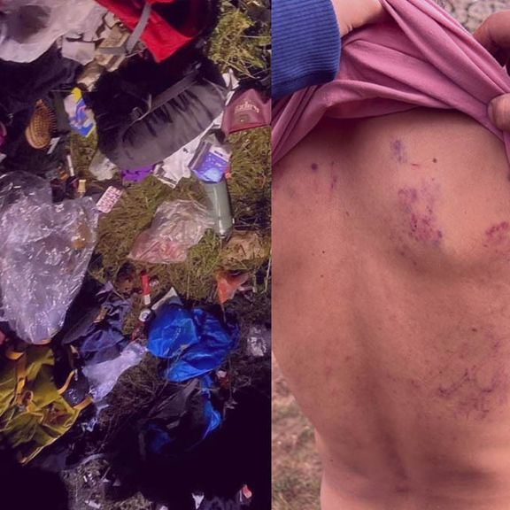 یکی از مضروبان کمپ اوپرت: مهاجمان نظامی بودند، زدند و گفتند حالا فهمیدید عاشورا چه شده