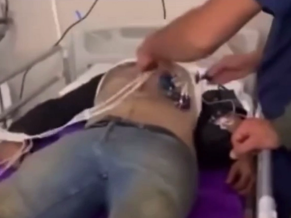 نشریه فراز: یکی از مضروبان حمله سپاه به گردشگران در منطقه اوپرت برای همیشه فلج شده است