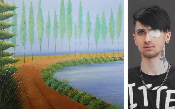 آرتین احمدی، معترض مجروح: توانستم اولین نقاشی را بعد از آسیب دیدن چشمام بکشم