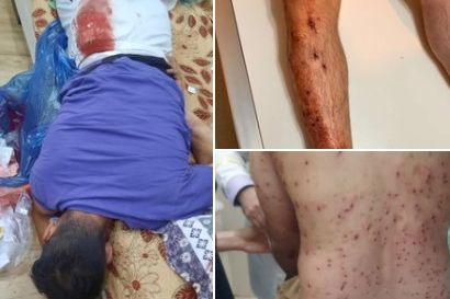 Some of the protesters injured in Abdanan on June 1, 2023