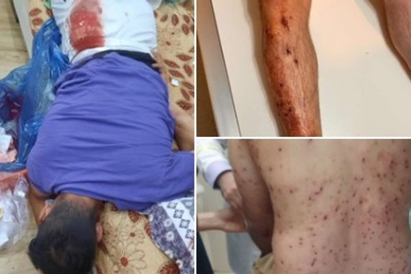 10 مصابين إثر مظاهرات ليلية في آبدانان إيران.. احتجاجا على وفاة غامضة لطالب جامعي