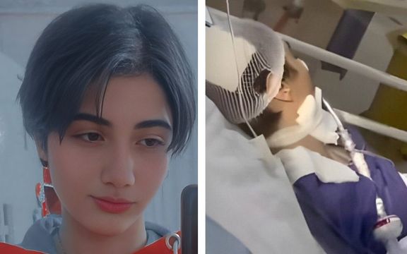 کمیته حقیقتیاب سازمان ملل: در حال بررسی حمله گزارششده به آرمیتا گراوند هستیم