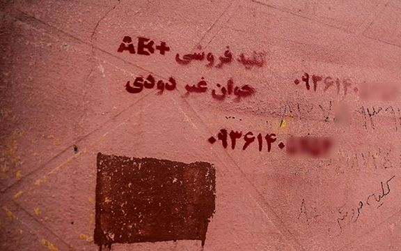 یک مقام انجمن حمایت از بیماران کلیوی: برخی شهروندان برای فروش کلیه خود به عراق میروند