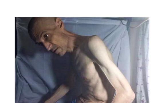 فرهاد میثمی، فعال سیاسی زندانی در اثر اعتصاب غذا دچار کاهش شدید وزن شده است