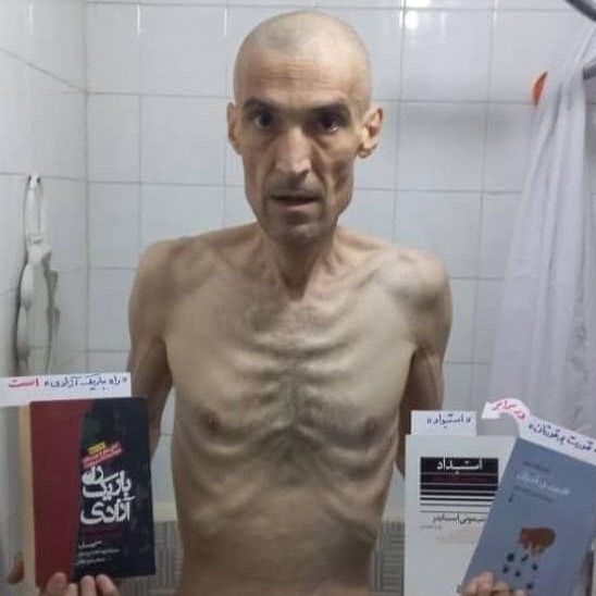 Farhad Meysami lost almost half his wight after more than three months