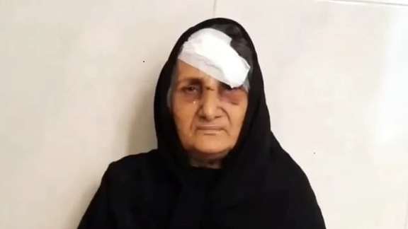Gohar Eshghi, mother of a blogger who died in custody in 2012 showing her injuries.