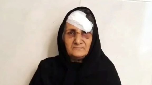 Gohar Eshghi, mother of a blogger who died in custody in 2012 showing her injuries.