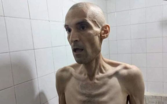 An Anti-Hijab Prisoner In Iran Seriously Ill After Hunger Strike