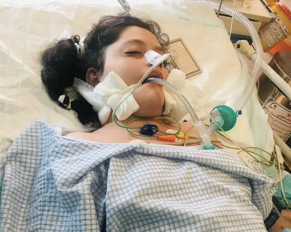 یک فرمانده سابق سپاه: بر اساس بررسی پزشکی قانونی، ضربه به جمجمه علت مرگ مهسا امینی است