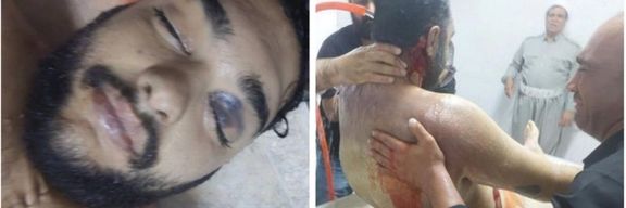 Injuries and bruises on Peyman Galvani's face and head (July 2023)