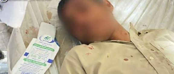 دانشآموزی در شهرستان سرباز درون خودروی سوختبر دچار مصدومیت شدید شده است