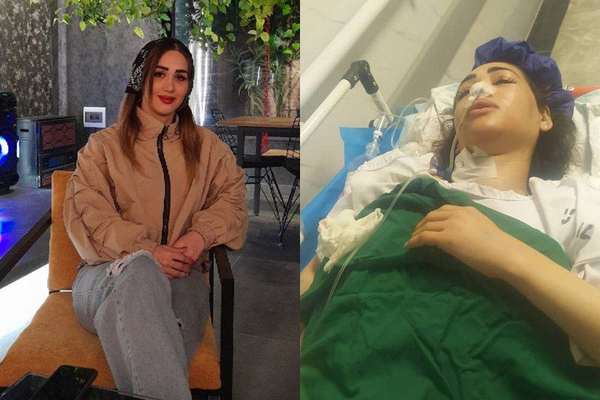 ضغوط أمنية على عائلة سيدة تعرضت لإطلاق نار من الأمن الإيراني لسحب دعواها ضد الشرطة
