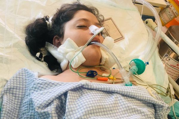مصادر طبية لـ"إيران إنترناشيونال": تحطم أنسجة دماغ مهسا أميني بسبب "عدة ضربات"