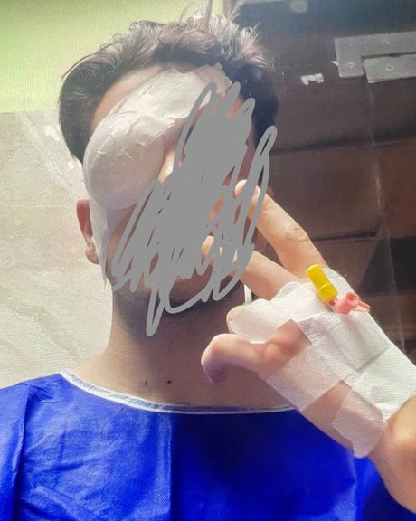 A protester blinded by birdshots