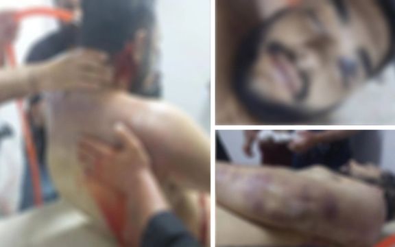 تصاویری از پیکر شکنجهدیده پیمان گلونی، زندانی کشتهشده در ارومیه