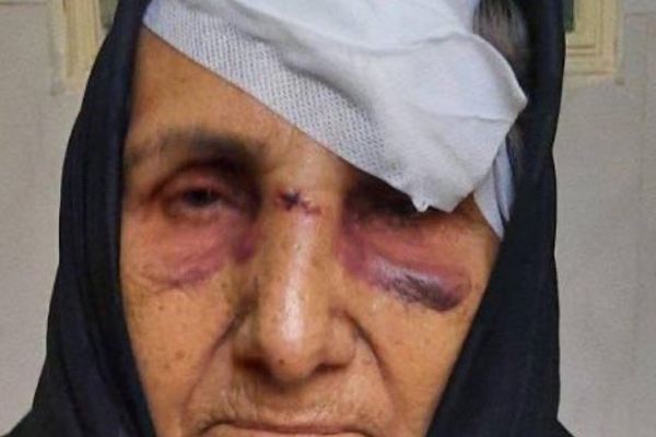 والدة معتقل سابق مات تحت التعذيب عن تعرضها لاعتداء: مجهولان ألقيا بي على حديد البناء