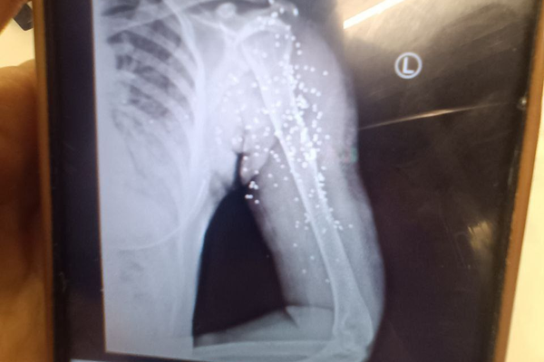پیام مخاطبان: پرستاران و پزشکان تلاش کردند معترضان قربانی ماموران حکومت نشوند