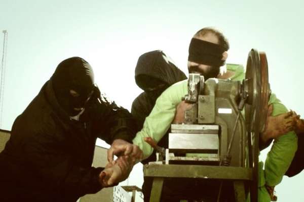 Fingers Of Iranian Prisoner Cut Off With New Guillotine
