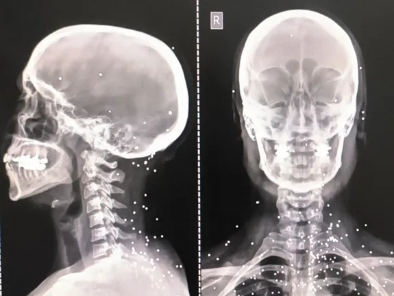 گزارش گاردین از هدفگیری عمدی اعضای حیاتی بدن برای سرکوب معترضان در ایران