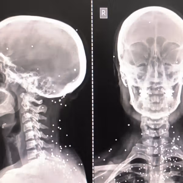 گزارش گاردین از هدفگیری عمدی اعضای حیاتی بدن برای سرکوب معترضان در ایران