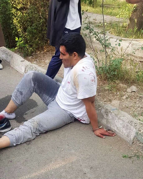 Iranian boxer Reza Moradkhani after he was shot by a hijab police