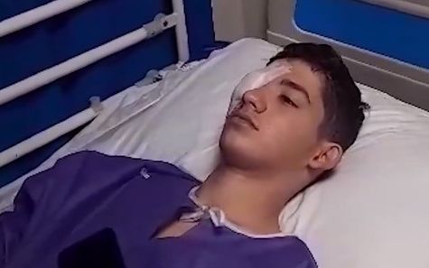 شلیک ماموران به یک نوجوان، ۱۶ ماه پس از خیزش انقلابی او را نابینا کرد