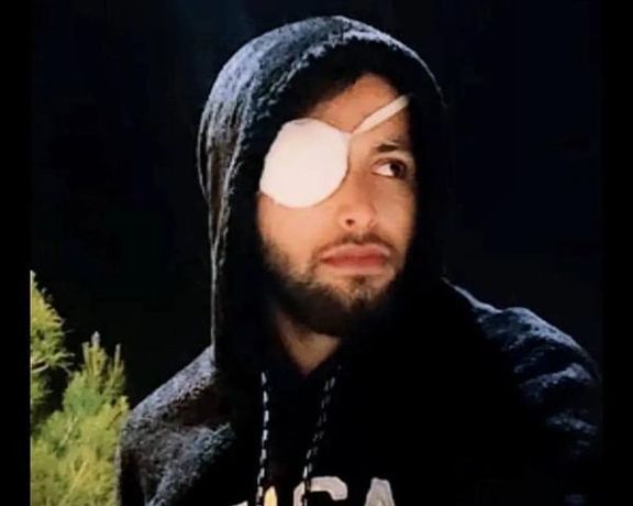 Iranian Protester Who Lost Eye In 2022 Protests Sentenced To Prison