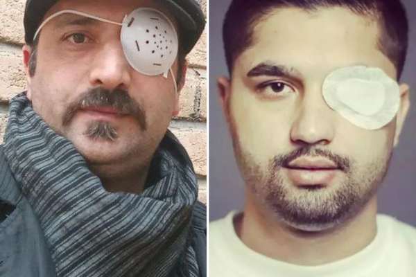 السلطات الإيرانية تواصل تهديد المصابين في أعينهم أثناء الاحتجاجات واعتقالهم
