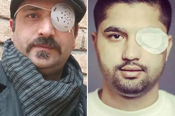 السلطات الإيرانية تواصل تهديد المصابين في أعينهم أثناء الاحتجاجات واعتقالهم