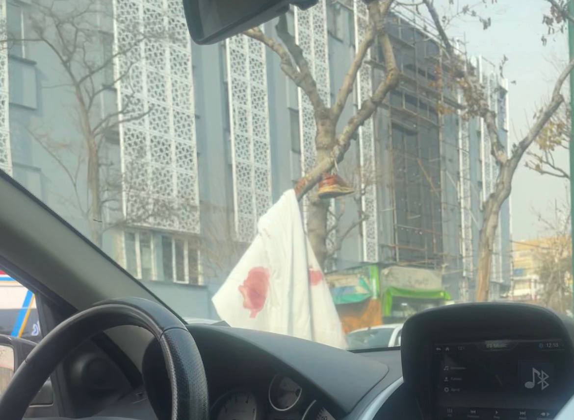 ملحفه خونی که مقابل بیمارستان تهرانپارس قرار داده شد