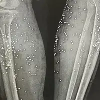 معترضانی که شواهد سرکوب در ایران را با خود حمل میکنند