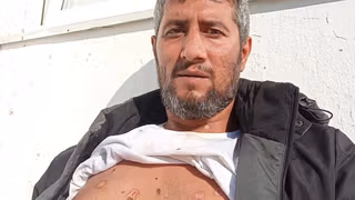 ناشط سياسي إيراني: تعرّضتُ للتعذيب في مخيم للاجئين بسبب عدائي لنظام طهران