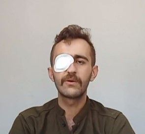 ایوب عبداللهی‌ که چشمش در خیزش انقلابی آسیب‌ دیده است از سوی دولت ترکیه تهدید به دیپورت شد