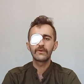 ایوب عبداللهی که چشمش در خیزش انقلابی آسیب دیده است از سوی دولت ترکیه تهدید به دیپورت شد