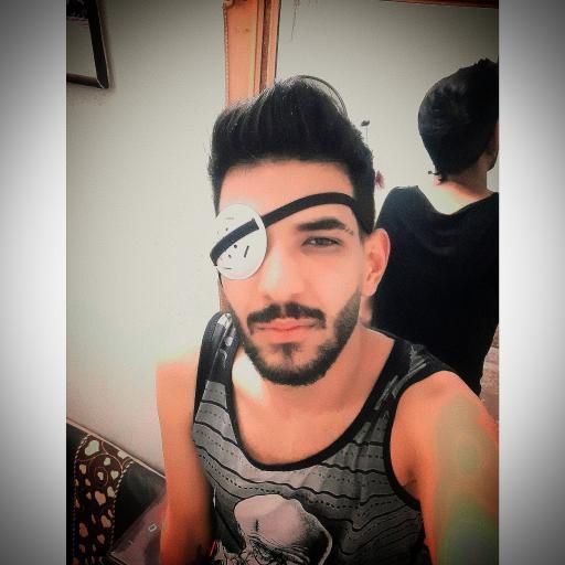 بهروز حسینی، معترض ۲۱ساله ساکن فولادشهر، روز ۲۴ آبان ۱۴۰۱ چشمش هدف گلوله ساچمه قرار گرفت