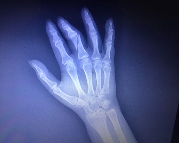 گزارشگران بدون مرز حمله مامور حراست به فائزه مومنی، خبرنگار را که باعث آسیبش شد، محکوم کرد