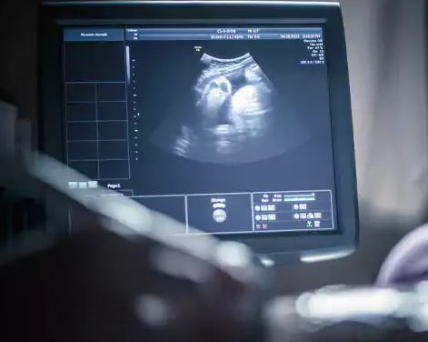 واکنشها به توقف تولید و واردات کیتهای غربالگری؛ احتمال تولد نسلی با ناهنجاری ژنتیکی