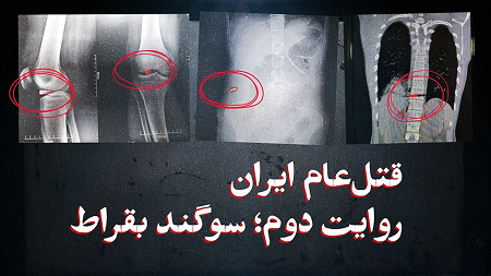 مستند «قتل‌ عام ایران، قسم بقراط» 
