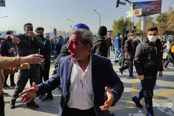 A man shot with shotgun 'bird shots' in Esfahan on November 26, 2021