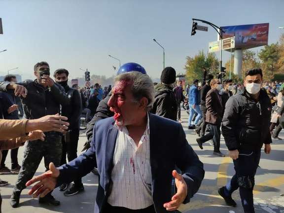 A protester in Esfahan shot by shotgun "bird shot" in the face. November 26, 2021