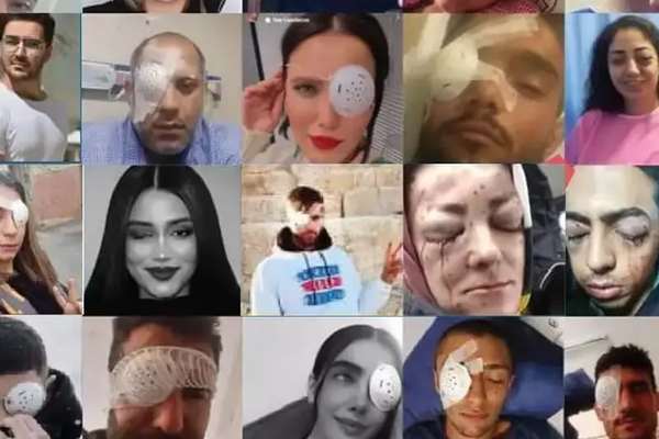 منظمة حقوق الإنسان الإيرانية تعلن عن 138 إصابة على الأقل في العين برصاص نظام طهران